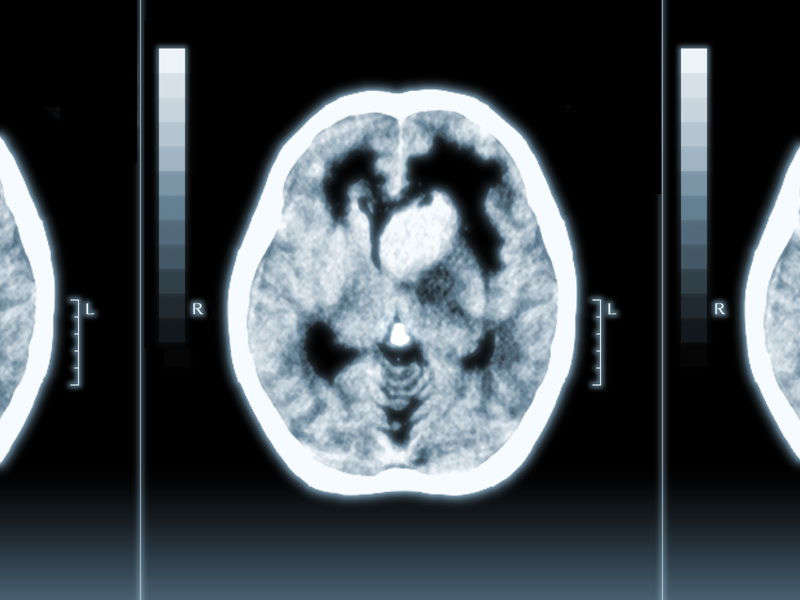 [070525][めろめろキュート] ドラクリウス 783/1211 